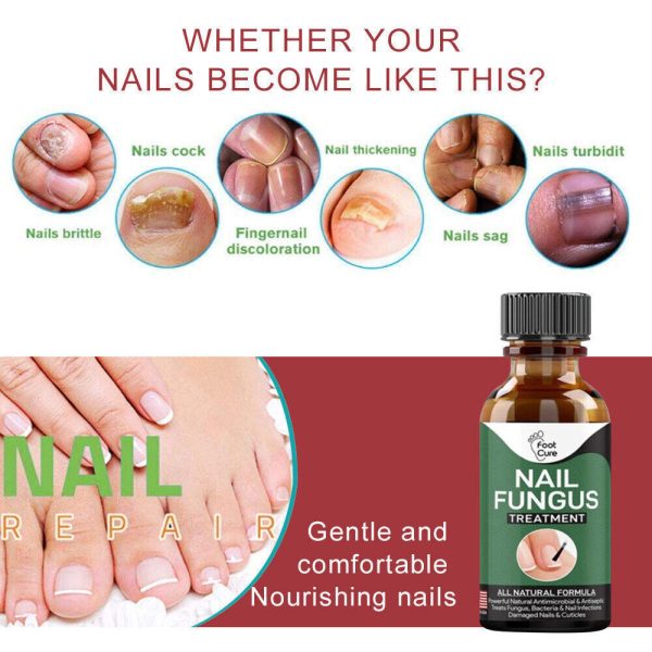 Foot Cure Nail Fungus Treatment - Image 8